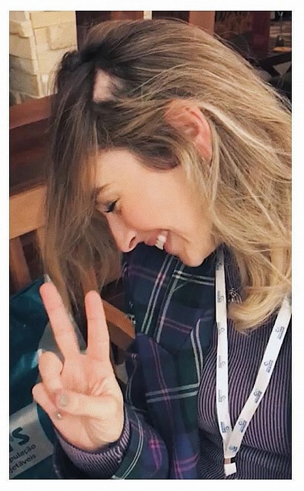 Desde que foi diagnosticada com alopecia areata, a médica Maitê H. César escolheu tratar a doença com carinho. Foto: Reprodução / Instagram Desde que foi diagnosticada com alopecia areata, a médica Maitê H. César escolheu tratar a doença com carinho. Foto: Reprodução / Instagram