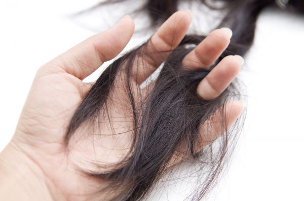 A doença sem cura que está deixando mulheres carecas é desencadeada por estresse Doença autoimune não tem cura e piora com o estresse. Foto: Bigstock
