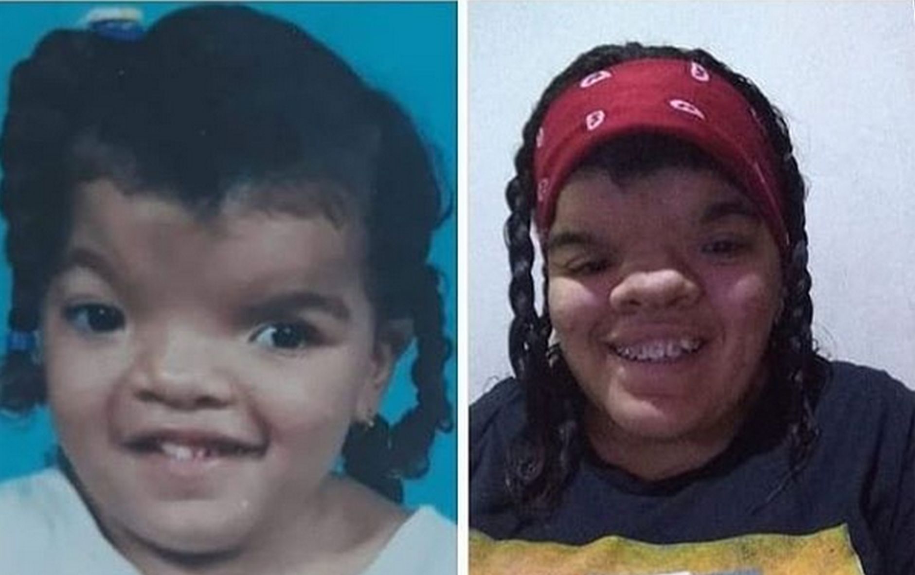 A garota recebe acompanhamento médico desde 2002 e realizou uma campanha online para conseguir sua cirurgia. Foto: Reprodução/Instagram