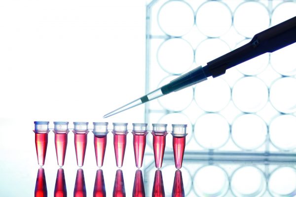 PCR alto: como interpretar um dos exames mais pedidos pelos médicos o exame de PCR é feito a partir de uma coleta simples de sangue, no qual será dosada a concentração da proteína C reativa, uma proteína produzida no fígado e elevada no sangue em condições especiais. Foto: Bigstock.