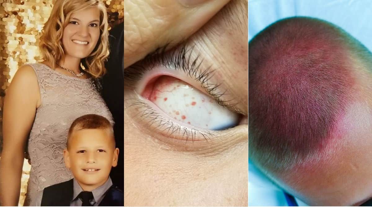 O menino de seis anos chegou a desmaiar depois de girar rápido demais. Foto: Reprodução Facebook O menino de seis anos chegou a desmaiar depois de girar rápido demais. Foto: Reprodução Facebook