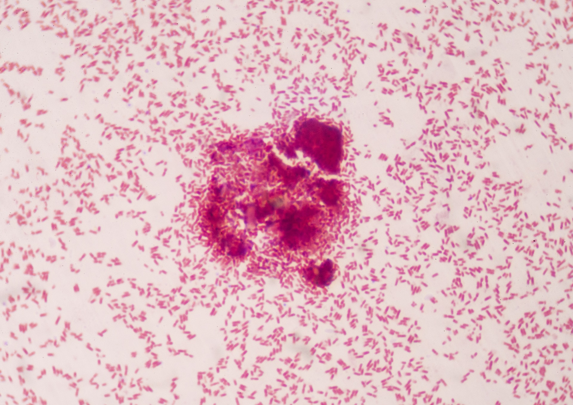 Kit não é indicado para uso rotineiro, mas para casos especiais, como descobrir o que provoca uma infecção em pacientes com septicemia, contaminação alimentar e infecções em próteses ortopédicas de difícil tratamento. Foto: Bigstock. 