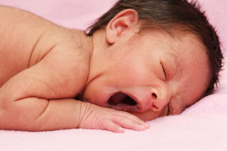 Na Espanha, 17 bebês tiveram sintomas da síndrome do lobisomem, com o crescimento de pelos por todo o corpo depois de tomarem um medicamento embalado errado. Foto: Bigstock.