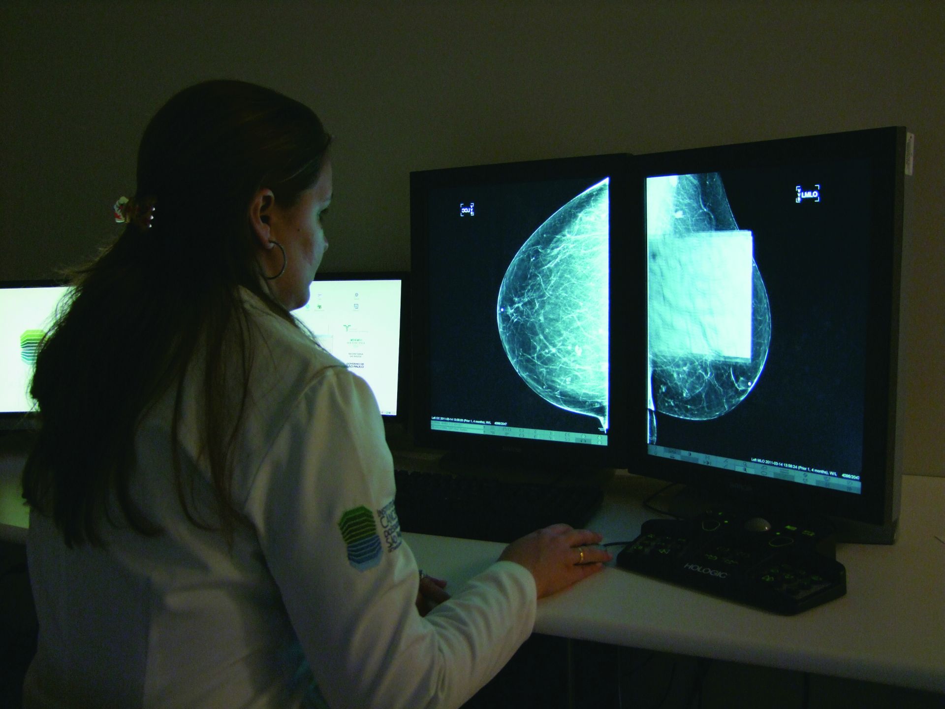 Mitos ainda persistem sobre o câncer de mama Foto: Divulgação