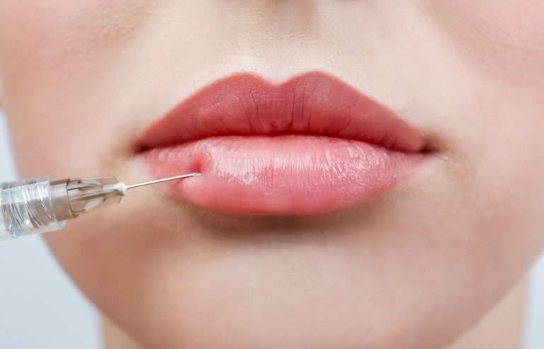 Campeões de procura nos consultórios médicos, o botox e o preenchimento com ácido hialurônico ou gordura costumam trazer resultados excelentes e têm grande indicação na medicina estética. Foto: Bigstock.