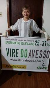 Epidermólise Bolhosa: as crianças borboletas